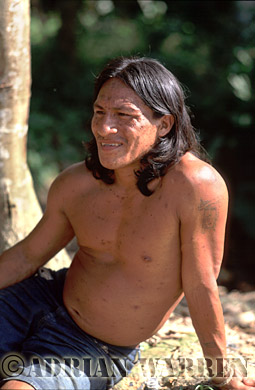 AW_Waorani1105, Waorani Indians : Pante suffering from Chicken Pox, rio Cononaco, Ecuador, 2002
